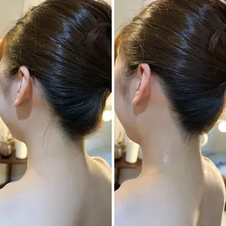 うなじ脱毛/美肌脱毛 LABELのエステ・リラクイメージ