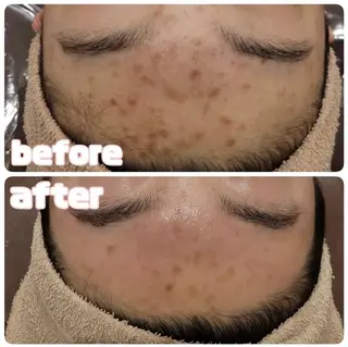 🎀美肌サロン レイビス川崎店🎀のエステ・リラクイメージ