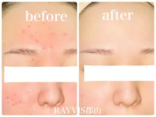 RAYVIS 郡山店のエステ・リラクイメージ