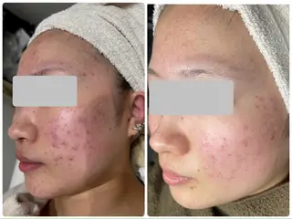 🦋肌改善 laule'a🦋のエステ・リラクイメージ