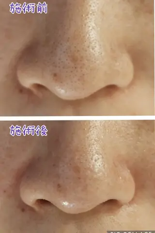 beauty salon    向日葵所属・beauty  salon 向日葵のエステ・リラクイメージ