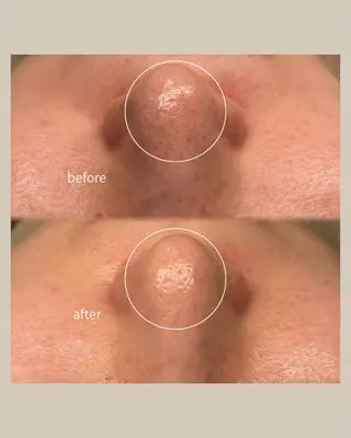 毛穴と脱毛のお店 "Lea" 壷林のエステ・リラクイメージ