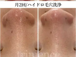 TRINIENCE 南流山店のエステ・リラクイメージ