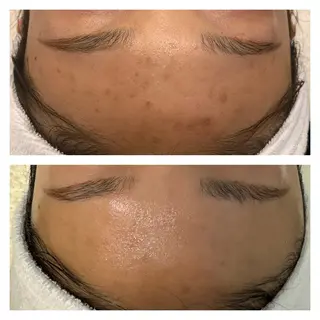 ナリスビューティサロンあべの所属・肌質改善/ツヤ肌作り /松本杏奈のエステ・リラクイメージ