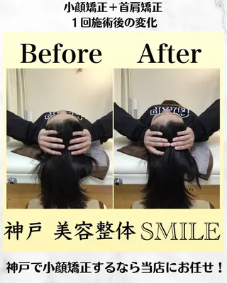 【小顔・姿勢矯正】 美容整体 SMILEのエステ・リラクイメージ