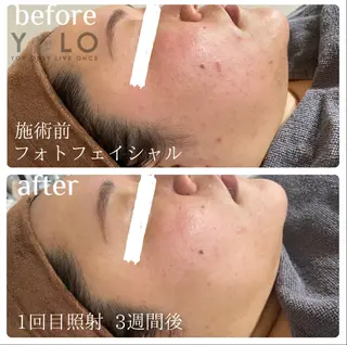 YOLO 梅郷店所属・YOLO痩身/脱毛 🌼MARI🌼のエステ・リラクイメージ