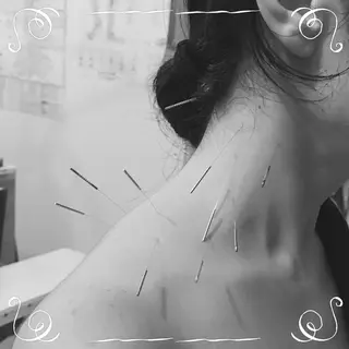 HARRY.Q 二子はりきゅう治療室所属・HARRY.Q 二子はりきゅう治療室のエステ・リラクイメージ