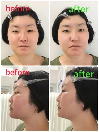 ポーラ Lumina 四日市所属・ポーラLumina 旧カヨー店のエステ・リラクイメージ