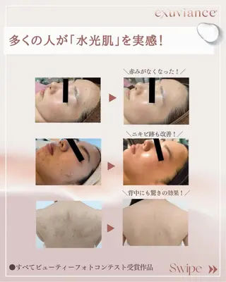 M. lisyelのエステ・リラクイメージ