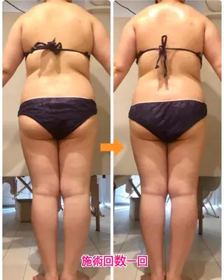 ロング カラー パーマ ヘアアレンジ メンズ キッズ ネイル マツエク・マツパ ‍痩身＆ボディ 結果出し🌟丹野のエステ・リラクイメージ