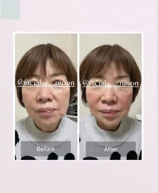 肌質改善サロン facialmoonのエステ・リラクイメージ