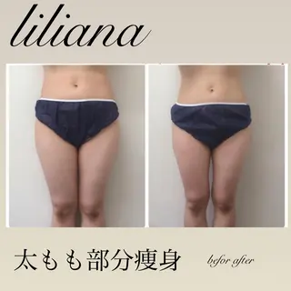 LILIANA所属・LILIANA ☆YURIのエステ・リラクイメージ