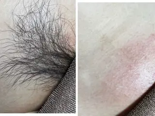 ワックス脱毛サロン 🎀新宿駅徒歩5分のエステ・リラクイメージ