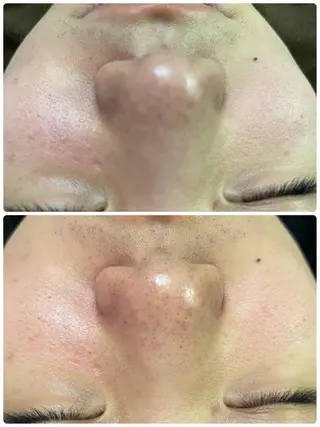 🔰 新米ネイリストのネイルデザイン