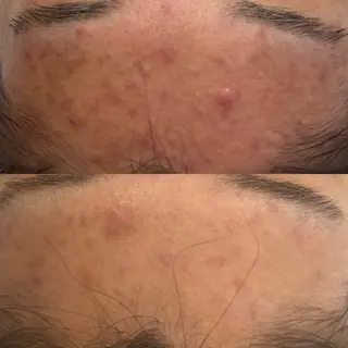 韓国🇰🇷価格 サロン_Nbibiのエステ・リラクイメージ