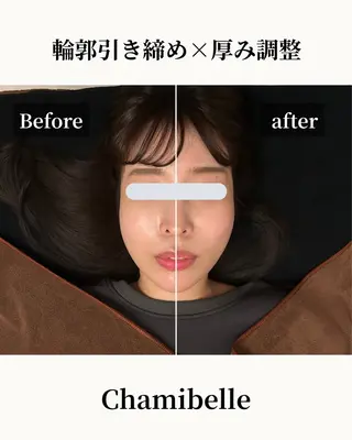 美容鍼灸サロン Chamibelleのエステ・リラクイメージ