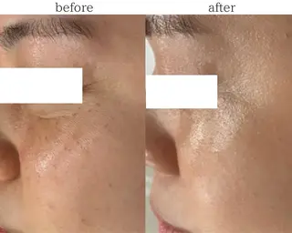 DahliaBeauty ダリアビューティー所属・DahliaBeau tyフェイシャル中村のエステ・リラクイメージ