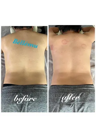 メンズ Salon de Béllému所属・Béllému ﾍﾞﾙｴﾐｭ　あおいのエステ・リラクイメージ