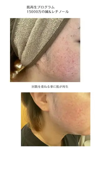 MA CHÉRIE所属・体質別痩身&小顔 MA CHÉRIEのエステ・リラクイメージ