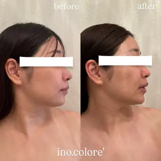 エステサロンino.colore'所属・小顔サロン ino.coloreのエステ・リラクイメージ