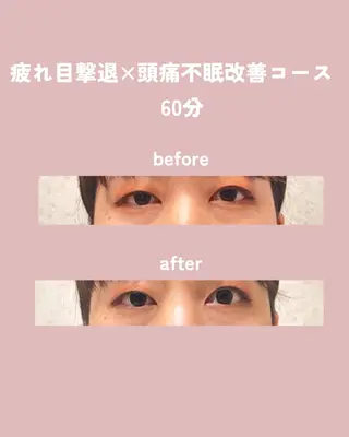 肩こり改善 専門店Fleuriのエステ・リラクイメージ