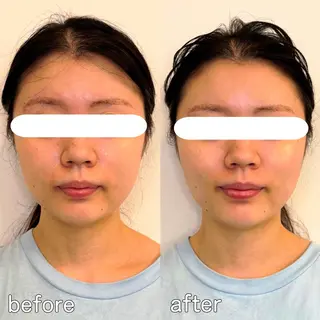 小顔矯正&美容整体 整え屋REDオーナーのエステ・リラクイメージ