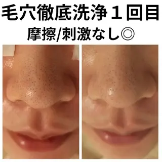 フェイシャル専門サロ ン ERINのエステ・リラクイメージ