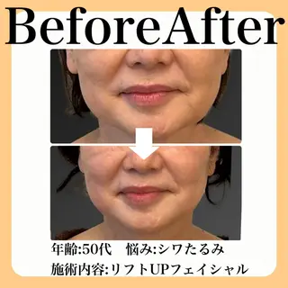 毛穴・たるみ･ニキビケア専門サロンsui所属・sui【スイ】 ARISAのエステ・リラクイメージ