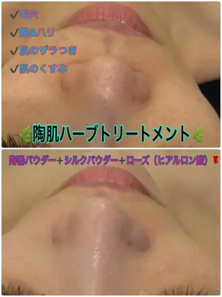 【リベルハーブピーリング認定店】敏感肌・美白脱毛専門店Dione立川店所属・Dione 立川店のエステ・リラクイメージ