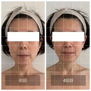 Eminy. HITOMIのエステ・リラクイメージ