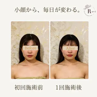 小顔サロンラヴィ　　船橋馬込沢店所属・小顔サロンラヴィ 船橋のエステ・リラクイメージ