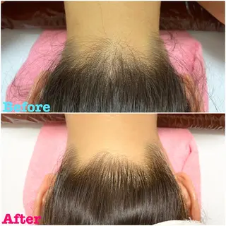 透明感の肌Lino malieのエステ・リラクイメージ