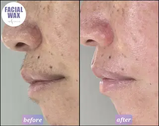 facial salon Lily所属・salon Lilyのエステ・リラクイメージ