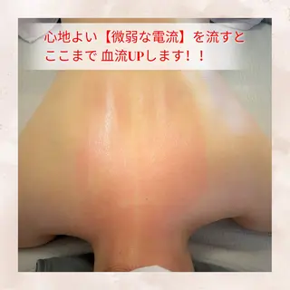 LaLa所属・小顔・たるみケア 専門店【&LaLa】のエステ・リラクイメージ