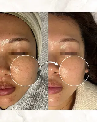 成宮鍼灸整骨院 & total  beauty  salon所属・中村 優美のエステ・リラクイメージ