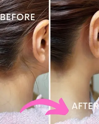 韓国肌&ララピール シミケア　せんすのエステ・リラクイメージ