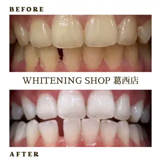 メンズ ホワイトニング ショップ葛西店のその他イメージ