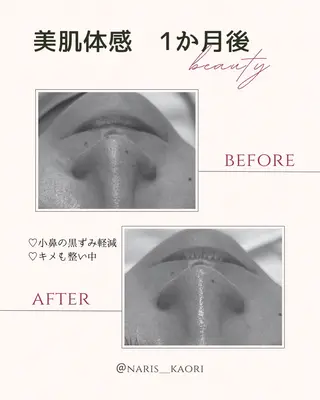 フェイシャルエステ♡ KAORIのエステ・リラクイメージ