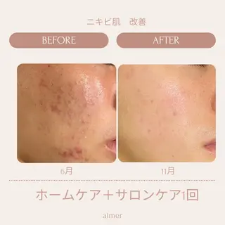 aimer beautyのエステ・リラクイメージ