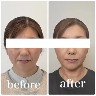 小顔と ヘッドスパのお店のエステ・リラクイメージ