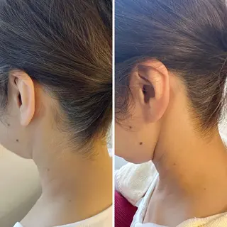 うなじ脱毛/美肌脱毛 LABELのエステ・リラクイメージ