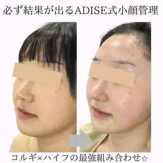 第一印象専門サロン ADISEのエステ・リラクイメージ