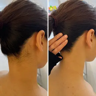 うなじ脱毛/美肌脱毛 LABELのエステ・リラクイメージ