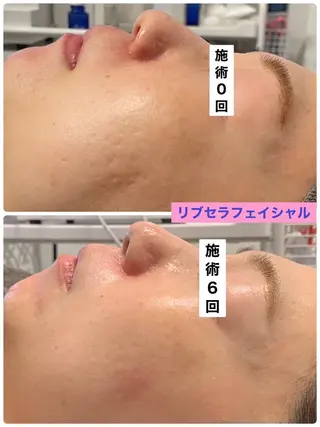 Private Salon Prunelle所属・プライベートサロン プリュネルのエステ・リラクイメージ