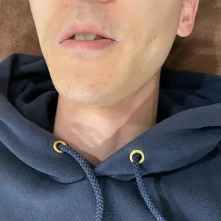 セルフエステエンリケ明石大久保店所属・夕希 毛穴と脱毛特化サロンのエステ・リラクイメージ