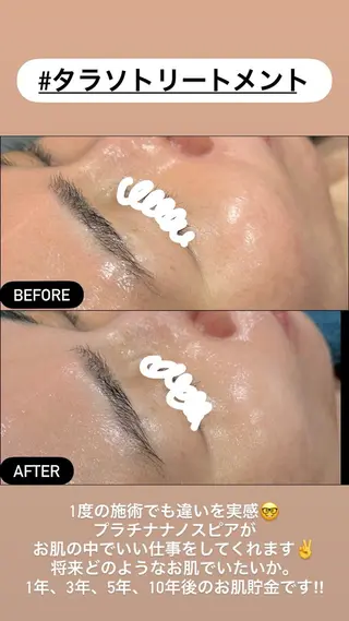 LiZA エステティックサロンのエステ・リラクイメージ