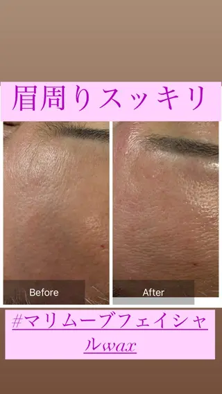 アイブロウ 産毛専門店 Bittoのエステ・リラクイメージ