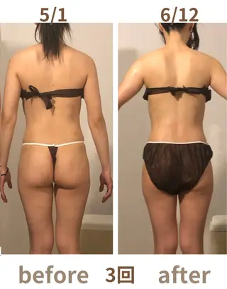 小顔・痩身専門店 Sunao所属・小顔.足痩せ整体 痩身天六Sunaoのその他イメージ