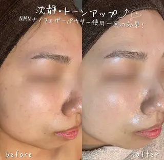 NA skin たまプラーザ　川島のエステ・リラクイメージ