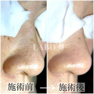 LABO-9所属・田中 捺未のエステ・リラクイメージ